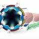 EGIS Flower Stent1.jpg